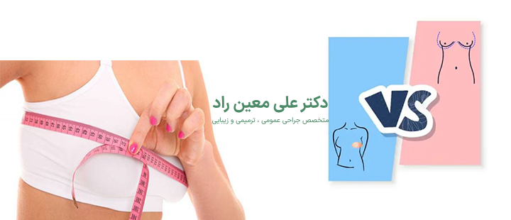 آشنایی با ماموپلاستی 