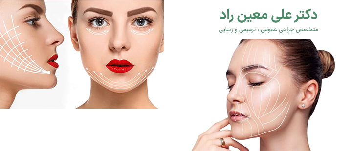 درباره اندولیفت