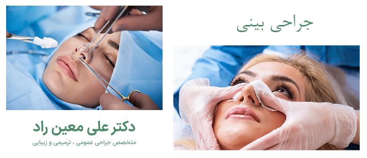 درباره جراحی بینی 
