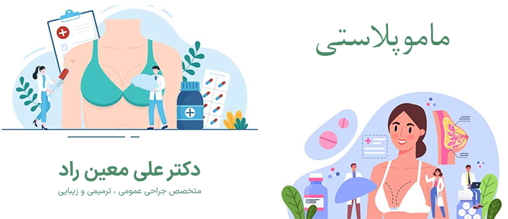 ماموپلاستی چیست؟