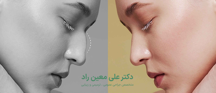 جراحی بینی استخوانی چگونه انجام می‌شود؟