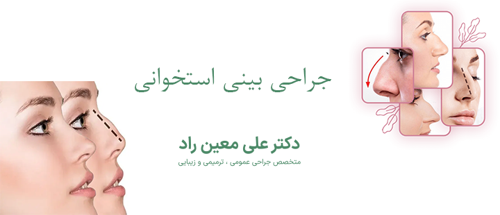 درباره جراحی بینی استخوانی 