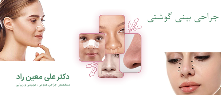 درباره جراحی بینی گوشتی 