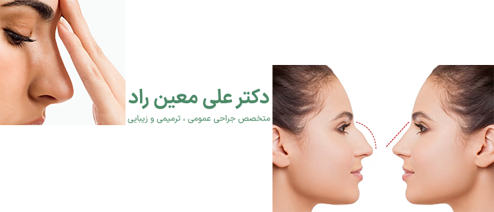 اندولیفت بینی چگونه انجام می‌شود؟