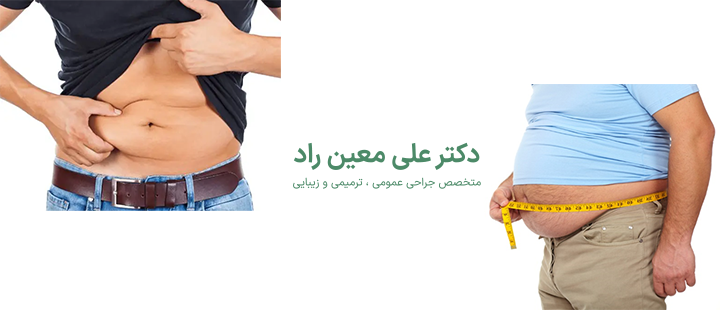 آشنایی با کاندید مناسب ابدومینوپلاستی 
