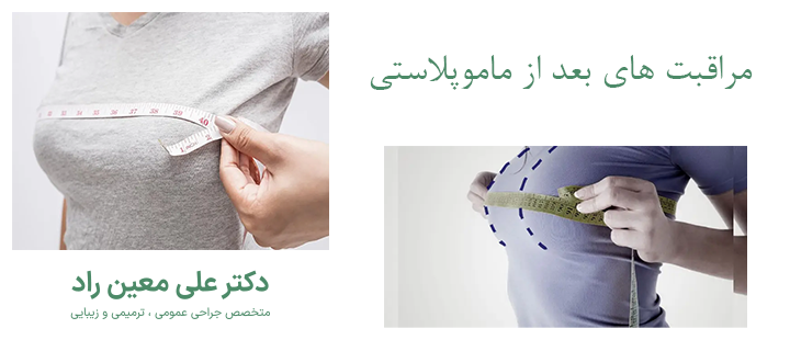 درباره مراقبت های بعد از ماموپلاستی 