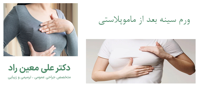 درباره ورم سینه بعد از ماموپلاستی