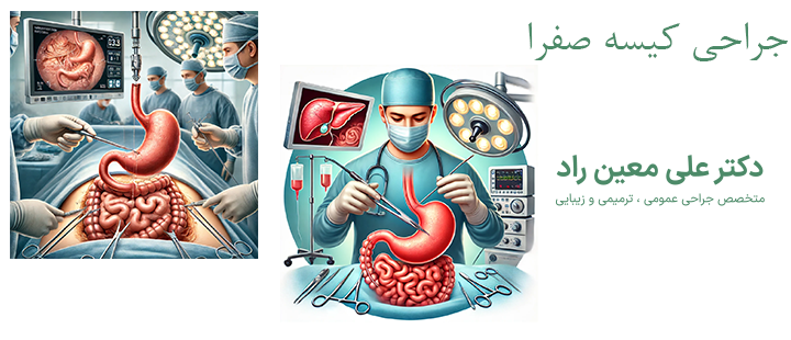 درباره جراحی کیسه صفرا 