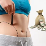 هزینه لیپوساکشن