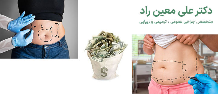 هزینه لیپوساکشن چقدر است؟