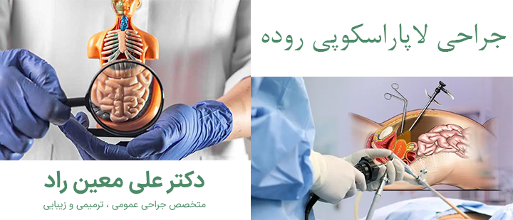 جراحی لاپاراسکوپی روده چیست؟