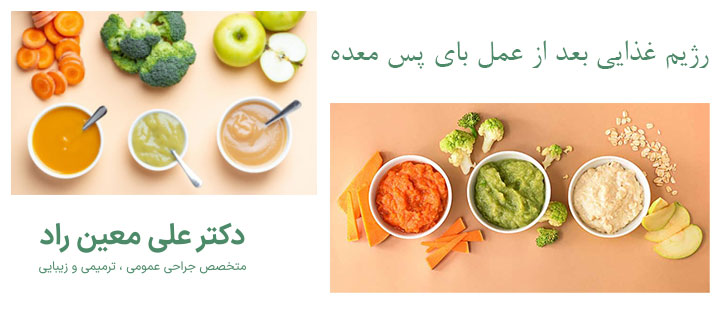 درباره رژیم غذایی بعد از عمل بای پس معده 