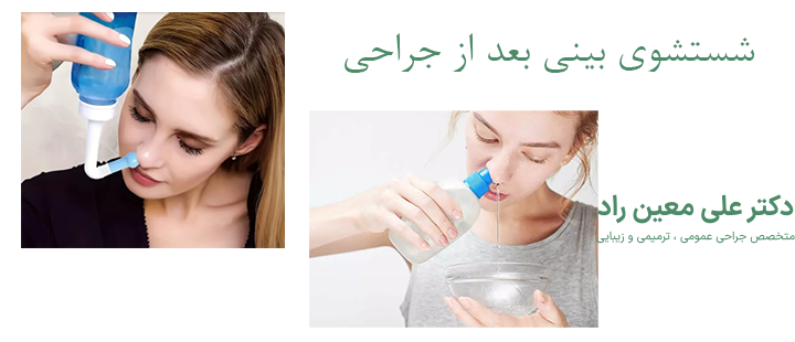 درباره شستشوی بینی بعد از جراحی 
