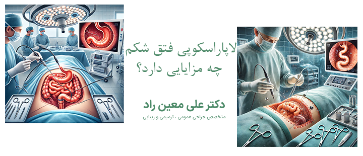 لاپاراسکوپی فتق شکم چه مزایایی دارد؟