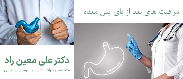مراقبت های بعد از بای پس معده