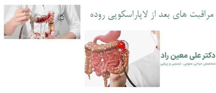 مراقبت های بعد از لاپاراسکوپی روده 