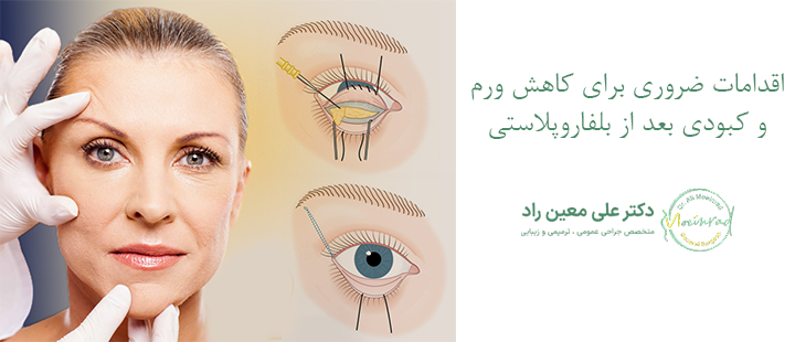  اقدامات ضروری برای کاهش ورم و کبودی