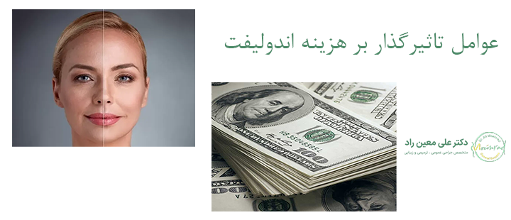 عوامل تاثیرگذار بر هزینه اندولیفت