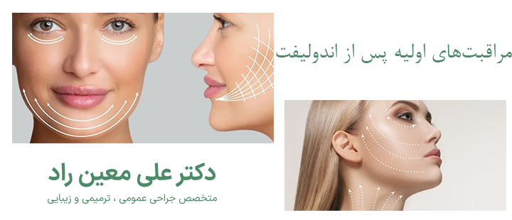مراقبت های اولیه بعد از اندولیفت