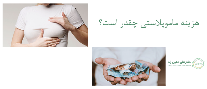 هزینه ماموپلاستی چقدر است؟