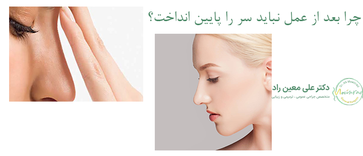 چرا بعد از عمل نباید سر را پایین انداخت؟