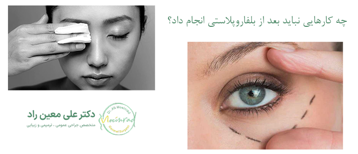  چه کارهایی نباید بعد از بلفاروپلاستی انجام داد؟