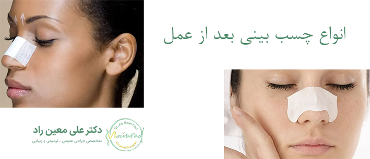 انواع چسب بینی مورد استفاده بعد از عمل