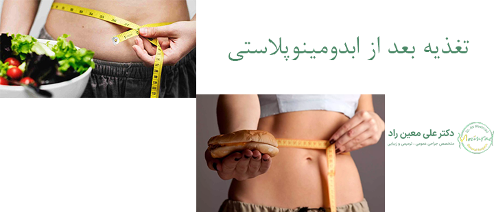 تغذیه بعد از ابدومینوپلاستی