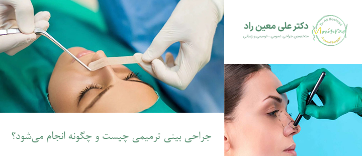 جراحی بینی ترمیمی چیست و چگونه انجام می‌شود؟