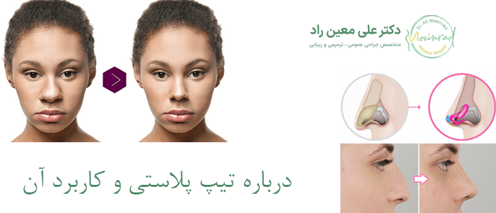 درباره تیپ پلاستی و کاربرد آن 
