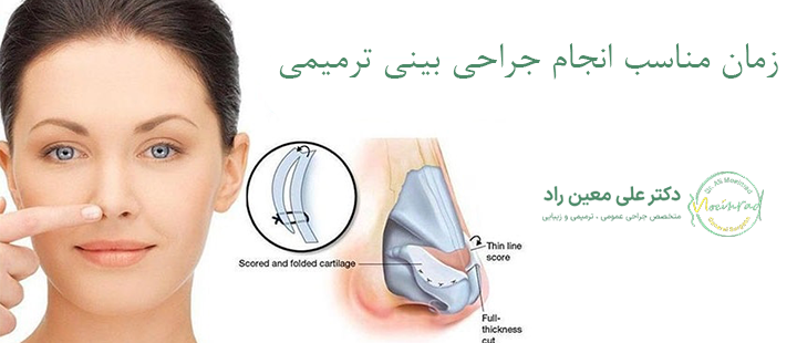 زمان مناسب انجام جراحی بینی ترمیمی 