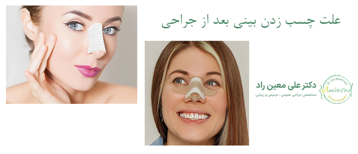 علت چسب زدن بینی بعد از جراحی