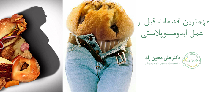 مهمترین اقدامات قبل از عمل ابدومینوپلاستی
