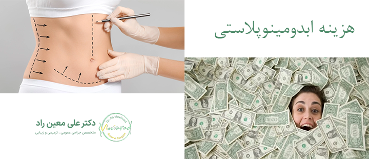 هزینه ابدومینوپلاستی چقدر است؟