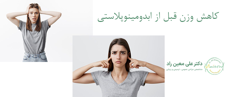 کاهش وزن قبل از ابدومینوپلاستی 