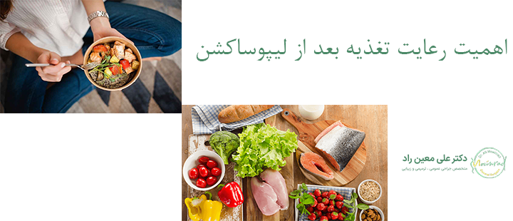 اهمیت رعایت تغذیه بعد از لیپوساکشن