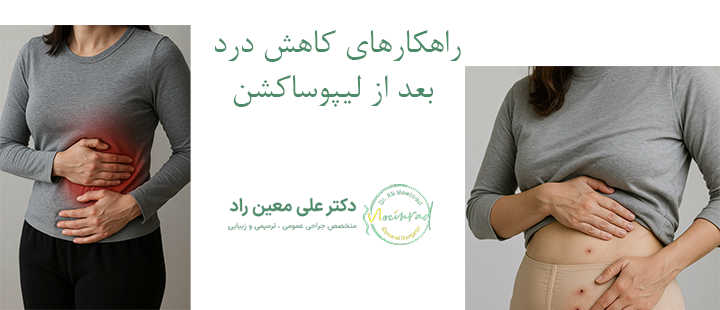 راهکارهای کاهش درد بعد از لیپوساکشن
