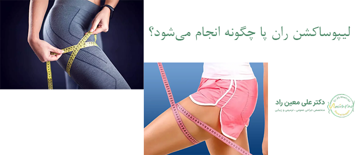 لیپوساکشن ران پا چگونه انجام می‌شود؟