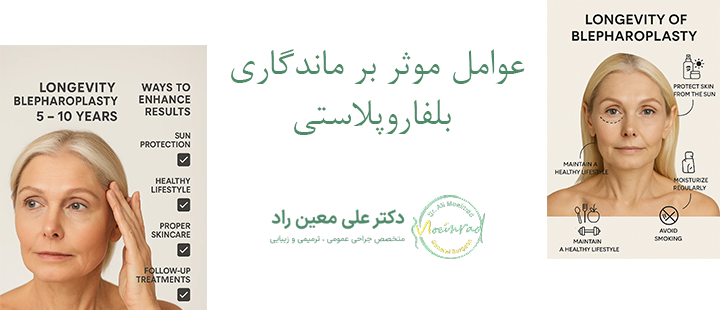 عوامل موثر بر ماندگاری بلفاروپلاستی چه مواردی است؟