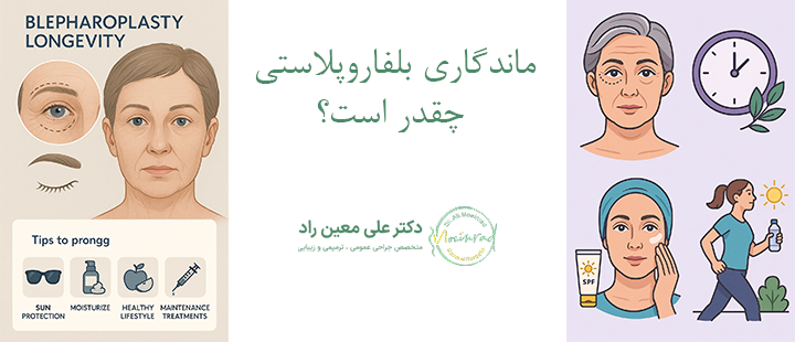 ماندگاری بلفاروپلاستی چقدر است؟