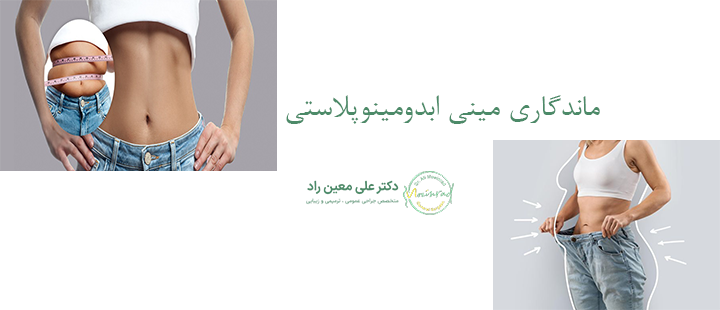 ماندگاری مینی ابدومینوپلاستی