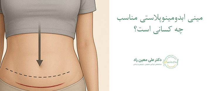 مینی ابدومنیوپلاستی برای چه کسانی مناسب است؟